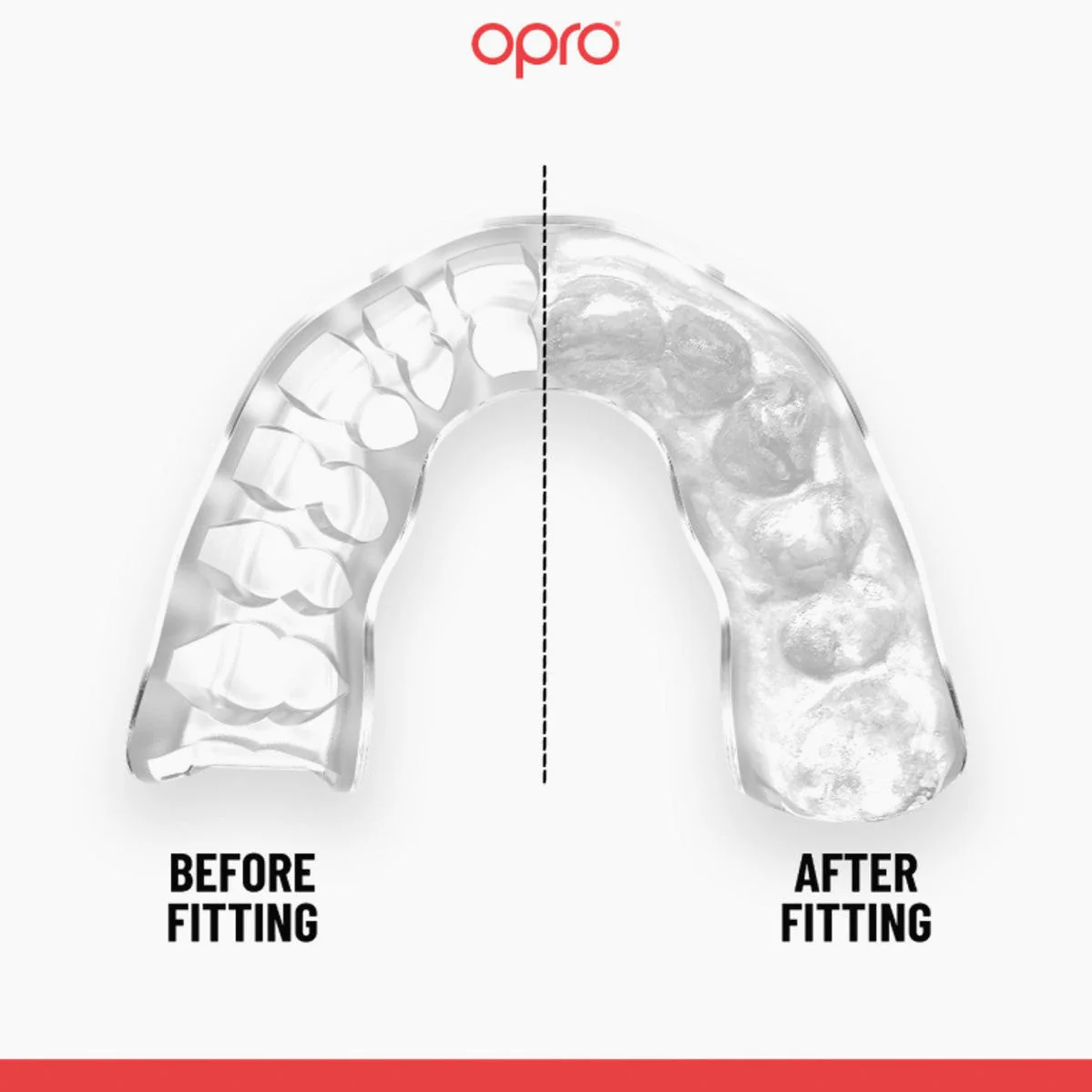 Protetor Bucal Opro Instant Custom-Fit - Image 7