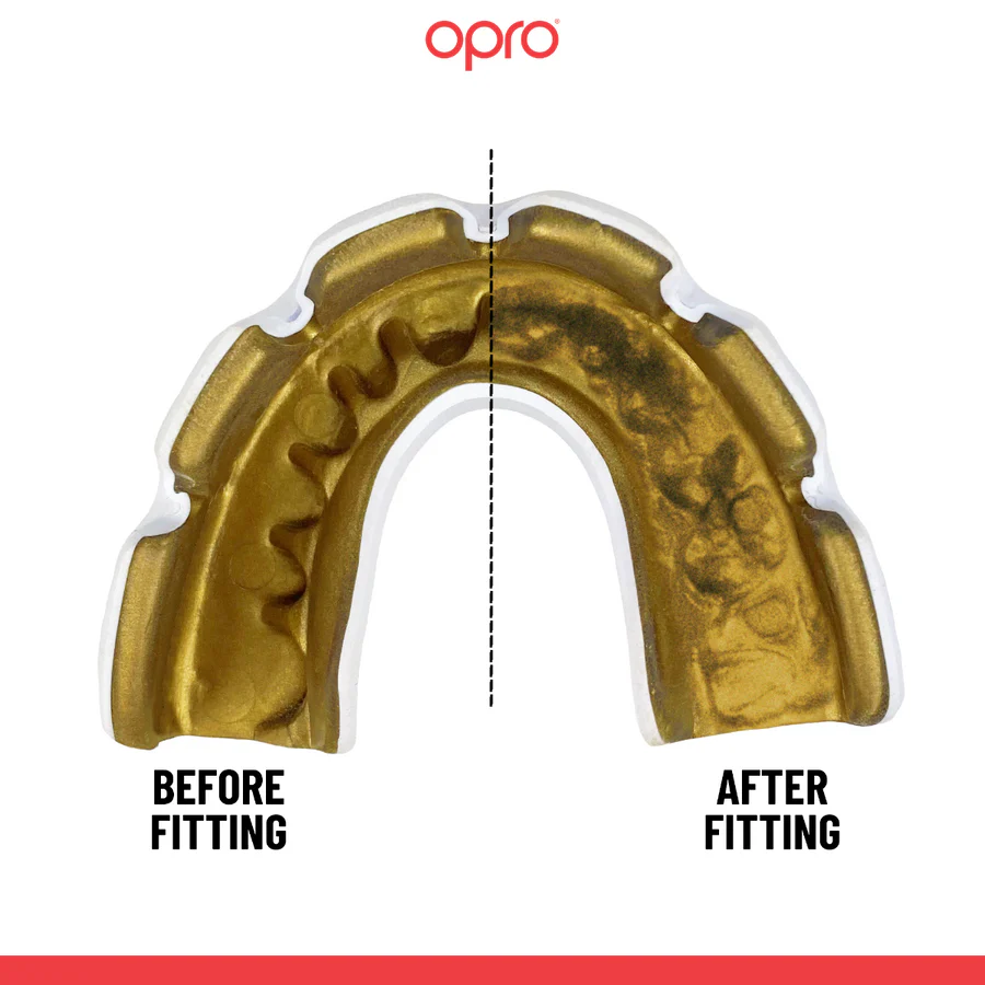 Protetor Bucal Opro Instant Custom-Fit para aparelho Branco-ouro  - Image 2