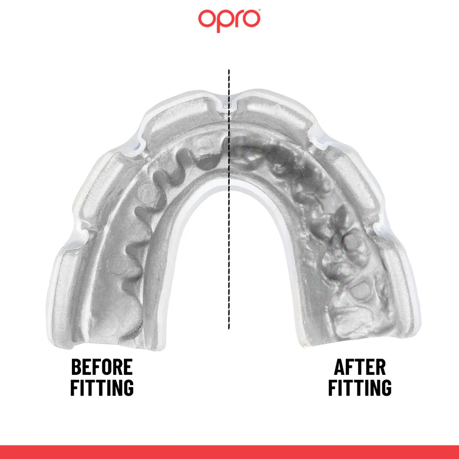 Protetor Bucal Opro Instant Custom-Fit para aparelho Transparente  - Image 2